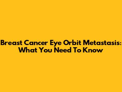 Breast Cancer Eye Orbit Metastasis: What You Need To Know