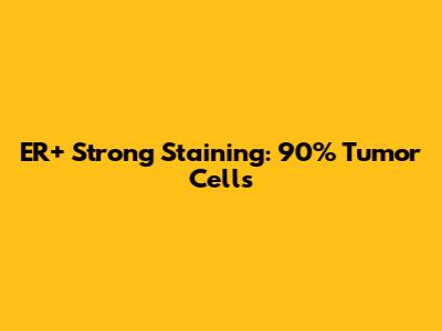 ER+ Strong Staining: 90% Tumor Cells