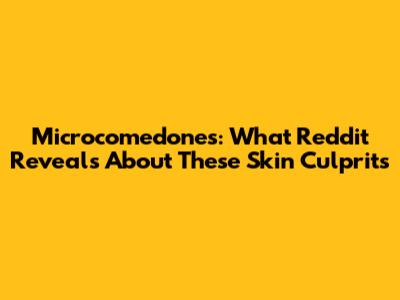 Microcomedones: What Reddit Reveals About These Skin Culprits