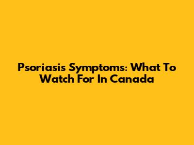 Psoriasis Symptoms: What To Watch For In Canada