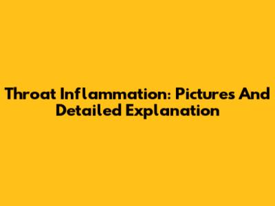 Throat Inflammation: Pictures And Detailed Explanation